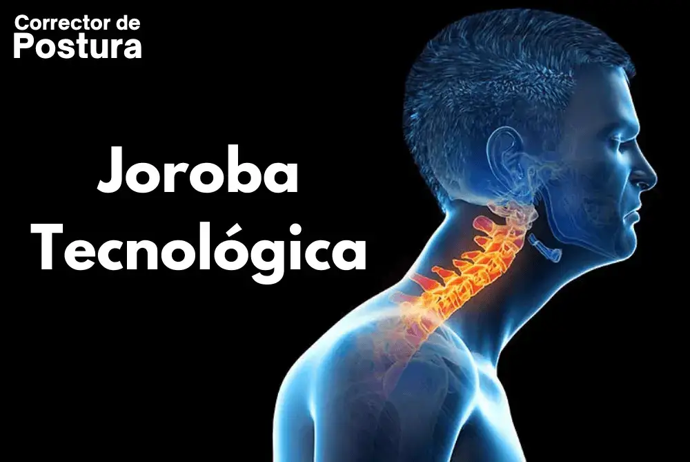 Joroba Tecnológica